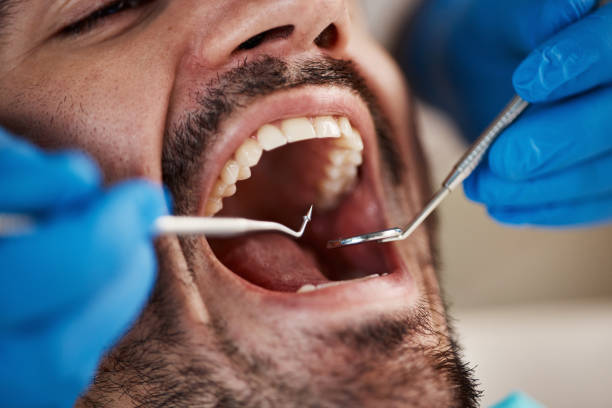 Best Emergency Broken Tooth Repair in Quitman, MS
